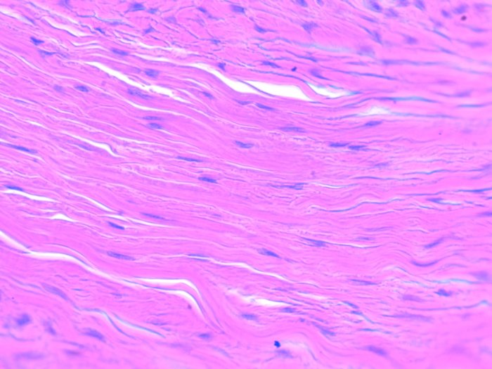 Tissue dense connective irregular histology howmed other include types